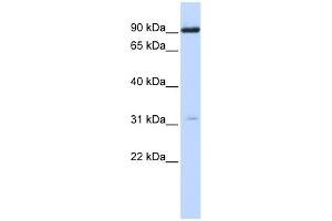 WB Suggested Anti-CHRNA4 Antibody Titration:  0. (CHRNA4 Antikörper  (N-Term))