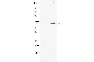 Western Blotting (WB) image for anti-Spleen tyrosine Kinase (SYK) (pTyr525) antibody (ABIN6255944)