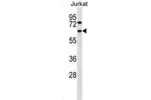 CCT4 Antibody (N-term) western blot analysis in Jurkat cell line lysates (35µg/lane). (CCT4 Antikörper  (N-Term))