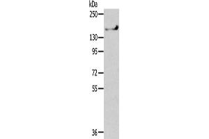 Gel: 6 % SDS-PAGE,Lysate: 40 μg,Primary antibody: ABIN7192352(SHANK1 Antibody) at dilution 1/200 dilution,Secondary antibody: Goat anti rabbit IgG at 1/8000 dilution,Exposure time: 1 minute (SHANK1 Antikörper)