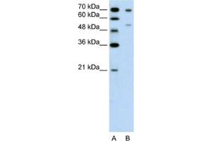 Western Blotting (WB) image for anti-Forkhead Box B2 (FOXB2) antibody (ABIN2462637) (FOXB2 Antikörper)