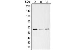 Western Blotting (WB) image for anti-Solute Carrier Family 29 (Nucleoside Transporters), Member 1 (SLC29A1) (N-Term) antibody (ABIN7295592)