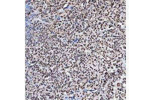 IHC analysis of SF3A3 using anti-SF3A3 antibody (ABIN7599863).