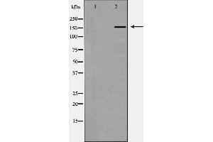 Western blot analysis of CUTL1 expression in K562 cells,The lane on the left is treated with the antigen-specific peptide. (CUX1 Antikörper  (N-Term))