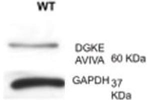DGKE antibody - N-terminal region  validated by WB using lymph at 1:1000. (DGKE Antikörper  (N-Term))