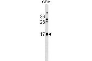 C Antibody (C-term) (ABIN1536654 and ABIN2849825) western blot analysis in CEM cell line lysates (35 μg/lane). (C2ORF83 Antikörper  (C-Term))