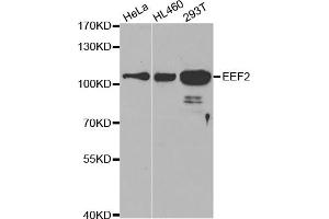 Western blot analysis of extracts of various cell lines, using EEF2 antibody (ABIN5971099) at 1/500 dilution. (EEF2 Antikörper)