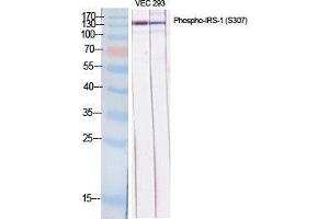 Western Blot (WB) analysis of specific cells using Phospho-IRS-1 (S307) Polyclonal Antibody. (IRS1 Antikörper  (pSer307))