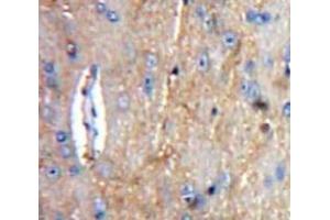 IHC-P analysis of Brain tissue, with DAB staining. (C1QA Antikörper  (AA 23-245))