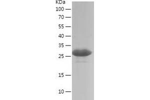 Western Blotting (WB) image for Ets Variant 5 (ETV5) (AA 1-200) protein (His tag) (ABIN7122825) (ETV5 Protein (AA 1-200) (His tag))
