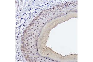 Immunohistochemistry of paraffin-embedded Mouse skin using SSC/SerpinB3 Rabbit mAb (ABIN7270242) at dilution of 1:100 (40x lens). (SERPINB3 Antikörper)