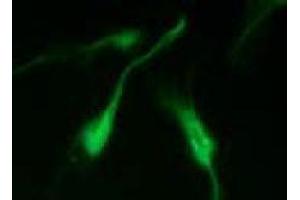 Immunofluorescence (IF) image for anti-Vimentin (VIM) (pSer50) antibody (ABIN1449160) (Vimentin Antikörper  (pSer50))