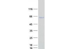 Western Blotting (WB) image for Ribophorin II (RPN2) (Transcript Variant 1) protein (Myc-DYKDDDDK Tag) (ABIN2730917)
