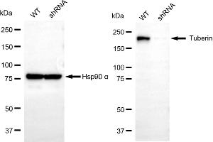 anti-Tuberous Sclerosis 2 (TSC2) antibody