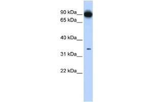 Western Blotting (WB) image for anti-Protein Kinase, Interferon-Inducible Double Stranded RNA Dependent Activator (PRKRA) (N-Term) antibody (ABIN2778860)