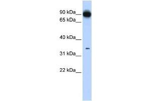 WB Suggested Anti-PRKRA Antibody Titration: 0. (PRKRA Antikörper  (N-Term))