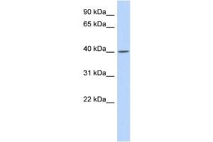 WB Suggested Anti-C11orf65 Antibody Titration: 0. (C11orf65 Antikörper  (N-Term))