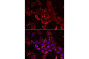 Immunofluorescence analysis of U2OS cells using MYOT antibody (ABIN5973839). (Myotilin Antikörper)