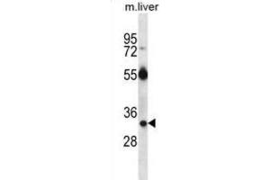 Western Blotting (WB) image for anti-RAS, Dexamethasone-Induced 1 (RASD1) antibody (ABIN2997144)
