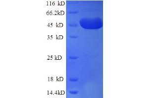 SDS-PAGE (SDS) image for DCP2 Decapping Enzyme Homolog (DCP2) (AA 1-385), (Isoform 2) protein (His tag) (ABIN5711505) (DCP2 Protein (AA 1-385, Isoform 2) (His tag))