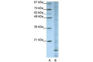 WB Suggested Anti-FAM121B Antibody Titration:  1. (APOO Antikörper  (N-Term))