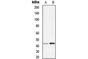 Western Blotting (WB) image for anti-serpin Peptidase Inhibitor, Clade B (Ovalbumin), Member 9 (SERPINB9) (Center) antibody (ABIN7296590)