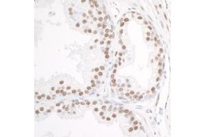 Immunohistochemistry (IHC) image for anti-DEAD (Asp-Glu-Ala-Asp) Box Polypeptide 5 (DDX5) (C-Term) antibody (ABIN7454642) (DDX5 Antikörper  (C-Term))