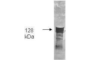 Both the antiserum and IgG fractions of anti-Glycerol Kinase (Cellulomonas) are shown to detect the 128,000 dalton enzyme in cellular extracts.