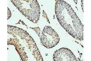 IHC analysis of DDX4/MVH using anti-DDX4/MVH antibody (ABIN7601204).