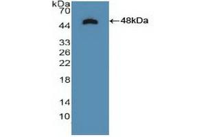 Detection of Recombinant NTRK2, Human using Polyclonal Antibody to Tropomyosin Receptor Kinase B (TrkB) (Tropomyosin Receptor Kinase B (AA 32-430) Antikörper)