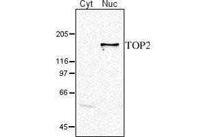 Image no. 1 for anti-DNA Topoisomerase II (TOP2) (C-Term), (N-Term) antibody (ABIN334538) (TOP2 Antikörper  (C-Term, N-Term))