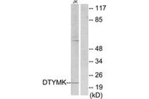 Western blot analysis of extracts from Jurkat cells, using DTYMK Antibody.