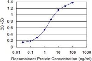 Detection limit for recombinant GST tagged SMS is 0. (SMS Antikörper  (AA 1-366))
