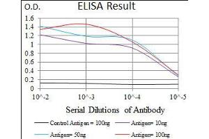 Black line: Control Antigen (100 ng), Purple line: Antigen(10 ng), Blue line: Antigen (50 ng), Red line: Antigen (100 ng), (WHSC2 Antikörper  (AA 280-511))