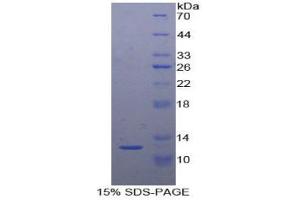 SDS-PAGE analysis of Chicken Semaphorin 3E Protein.