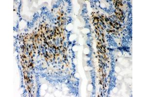 IHC analysis of RUNX3 using anti-RUNX3 antibody (ABIN3043318).