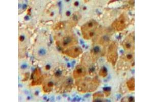 IHC-P analysis of Liver tissue, with DAB staining. (CPE Antikörper  (AA 151-317))