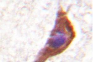 Image no. 1 for anti-NMDA Receptor 1 (NMDA R1) antibody (ABIN272046)