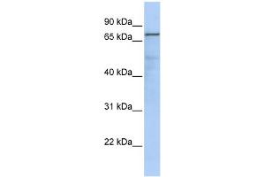 WB Suggested Anti-GMPS Antibody Titration:  0. (GMP Synthase Antikörper  (Middle Region))