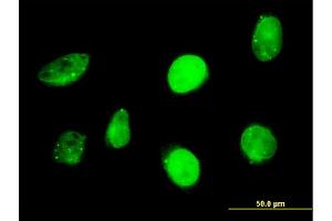 Immunofluorescence of monoclonal antibody to SP110 on HeLa cell. (SP110 Antikörper  (AA 271-380))