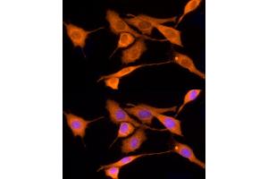 Immunofluorescence (IF) image for anti-Iduronate 2-Sulfatase (IDS) (AA 34-290) antibody (ABIN3015634)