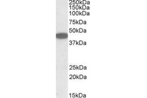 AP23738PU-N CXCR6 antibody staining of HEK293 lysate at 1 µg/ml (35µg protein in RIPA buffer). (CXCR6 Antikörper  (C-Term))
