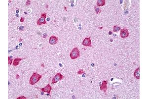 Anti-MLKL antibody IHC of human brain, cortex neurons. (MLKL Antikörper  (AA 371-472))