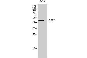 Western Blotting (WB) image for anti-C-terminal Binding Protein 2 (CTBP2) (C-Term) antibody (ABIN3174596) (CTBP2 Antikörper  (C-Term))
