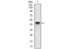Western blot analysis using ANPEP mAb against human ANPEP (AA: Extra(781-967)) recombinant protein.
