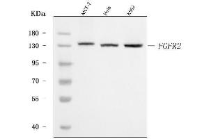 Western blot analysis of FGFR2 using anti-FGFR2 antibody (ABIN7600702).