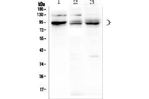 Western blot analysis of PHF21A using anti-PHF21A antibody (ABIN6719353).