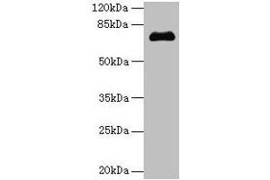 Western blot All lanes: PMEL antibody at 14 μg/mL + Jurkat whole cell lysate Secondary Goat polyclonal to rabbit IgG at 1/10000 dilution Predicted band size: 71, 61, 67 kDa Observed band size: 71 kDa (Melanoma gp100 Antikörper  (AA 25-467))