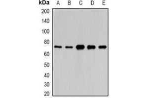 Western blot analysis of PAIP1 expression in HepG2 (A), A549 (B), mouse liver (C), mouse kidney (D), rat brain (E) whole cell lysates.