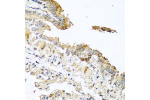 Immunohistochemistry of paraffin-embedded mouse lung using RNASE11 antibody at dilution of 1:100 (40x lens). (RNASE11 Antikörper)